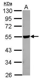 Anti-HYAL2 antibody [N2C2], Internal used in Western Blot (WB). GTX115123