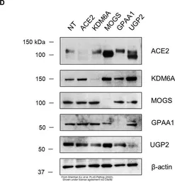 Anti-GPAA1 antibody used in Western Blot (WB). GTX115131
