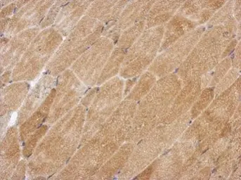 Anti-GPAA1 antibody used in IHC (Paraffin sections) (IHC-P). GTX115131