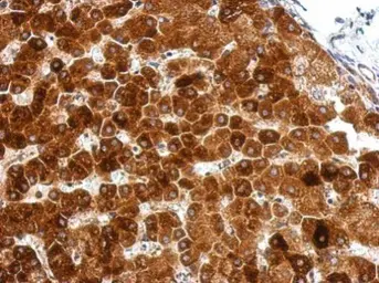 Anti-GPAA1 antibody used in IHC (Paraffin sections) (IHC-P). GTX115131