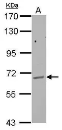 Anti-GPAA1 antibody used in Western Blot (WB). GTX115131