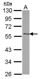 Anti-DLK1 antibody used in Western Blot (WB). GTX115136