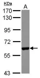 Anti-CES2 antibody used in Western Blot (WB). GTX115142