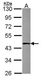 Anti-ABH1 antibody [N3C3] used in Western Blot (WB). GTX115145