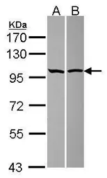 Anti-PAG3 antibody [N1N2], N-term used in Western Blot (WB). GTX115146