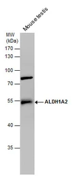 Anti-ALDH1A2 antibody [N1N3] used in Western Blot (WB). GTX115147