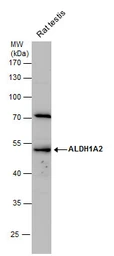 Anti-ALDH1A2 antibody [N1N3] used in Western Blot (WB). GTX115147