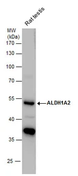 Anti-ALDH1A2 antibody [C1C3] used in Western Blot (WB). GTX115148