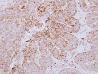 Anti-GYG2 antibody used in IHC (Paraffin sections) (IHC-P). GTX115157