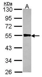 Anti-GYG2 antibody used in Western Blot (WB). GTX115157