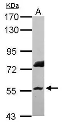Anti-RNF8 antibody [N3C3] used in Western Blot (WB). GTX115176