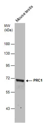 Anti-PRC1 antibody [N1N2], N-term used in Western Blot (WB). GTX115179