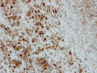 Anti-PRC1 antibody [N1N2], N-term used in IHC (Paraffin sections) (IHC-P). GTX115179