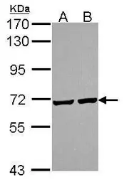 Anti-PRC1 antibody [N1N2], N-term used in Western Blot (WB). GTX115179