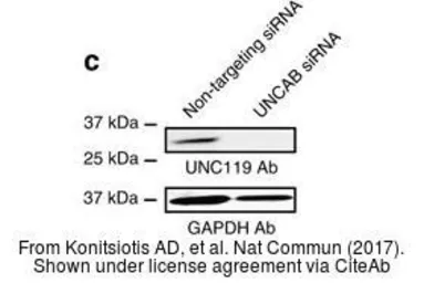 Anti-UNC119 antibody [N2C3] used in Western Blot (WB). GTX115185