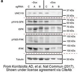 Anti-UNC119 antibody [N2C3] used in Western Blot (WB). GTX115185