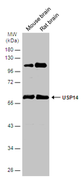 Anti-USP14 antibody used in Western Blot (WB). GTX115187