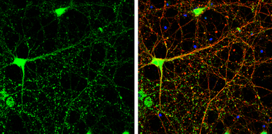 Anti-USP14 antibody used in Immunocytochemistry/ Immunofluorescence (ICC/IF). GTX115187