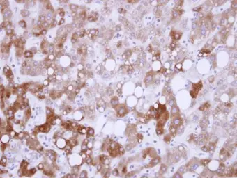 Anti-USP14 antibody used in IHC (Paraffin sections) (IHC-P). GTX115187