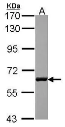 Anti-USP14 antibody used in Western Blot (WB). GTX115187