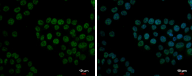 Anti-FCP1 antibody [N1N2], N-term used in Immunocytochemistry/ Immunofluorescence (ICC/IF). GTX115194