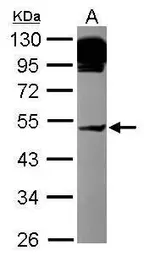 Anti-AP4M1 antibody [N1N3] used in Western Blot (WB). GTX115195