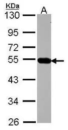 Anti-AP4M1 antibody [N1C1] used in Western Blot (WB). GTX115196