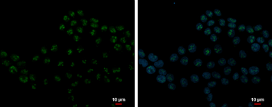 Anti-DDX21 antibody [N1N3] used in Immunocytochemistry/ Immunofluorescence (ICC/IF). GTX115199