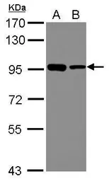 Anti-DDX21 antibody [N1N3] used in Western Blot (WB). GTX115199