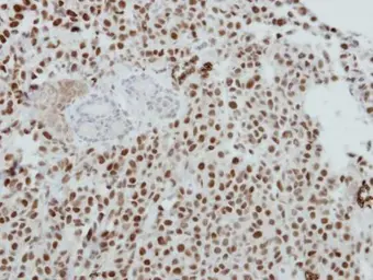 Anti-MTA2 antibody [N1N2], N-term used in IHC (Paraffin sections) (IHC-P). GTX115203