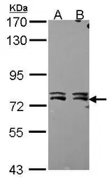 Anti-MTA2 antibody [N1N2], N-term used in Western Blot (WB). GTX115203