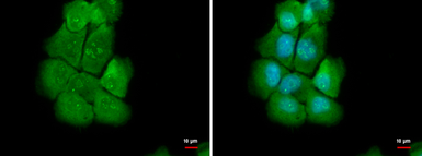 Anti-NOLC1 antibody used in Immunocytochemistry/ Immunofluorescence (ICC/IF). GTX115205