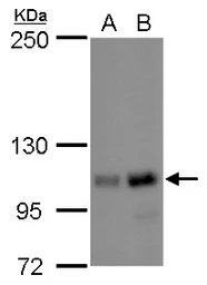 Anti-NOLC1 antibody used in Western Blot (WB). GTX115205