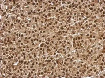 Anti-BCL7C antibody used in IHC (Paraffin sections) (IHC-P). GTX115214