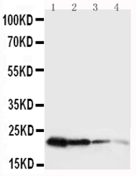 Anti-Growth Hormone antibody used in Western Blot (WB). GTX11522