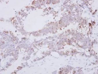 Anti-GRAP2 antibody used in IHC (Paraffin sections) (IHC-P). GTX115233