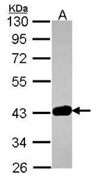 Anti-GRAP2 antibody used in Western Blot (WB). GTX115233