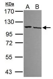 Anti-DDX23 antibody used in Western Blot (WB). GTX115234