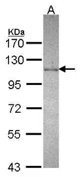 Anti-DDX23 antibody used in Western Blot (WB). GTX115234