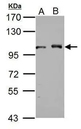 Anti-DDX23 antibody used in Western Blot (WB). GTX115235