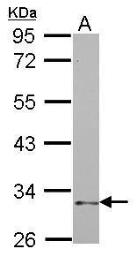 Anti-NKp46 antibody [N1C3] used in Western Blot (WB). GTX115238