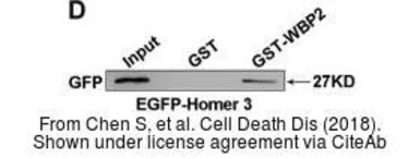 Anti-Homer3 antibody used in Western Blot (WB). GTX115242