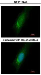 Anti-Homer3 antibody used in Immunocytochemistry/ Immunofluorescence (ICC/IF). GTX115242