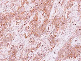 Anti-Homer3 antibody used in IHC (Paraffin sections) (IHC-P). GTX115242