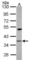 Anti-Homer3 antibody used in Western Blot (WB). GTX115242