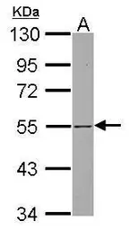 Anti-SH3BP5 antibody [N3C3] used in Western Blot (WB). GTX115245