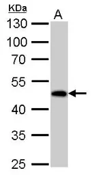 Anti-Guanine deaminase antibody used in Western Blot (WB). GTX115264