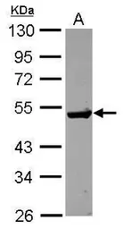 Anti-Guanine deaminase antibody used in Western Blot (WB). GTX115264