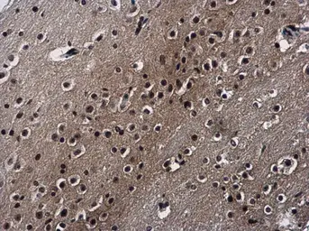 Anti-SAFB2 antibody [N2C1], Internal used in IHC (Paraffin sections) (IHC-P). GTX115272