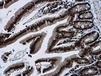 Anti-SAFB2 antibody [N2C1], Internal used in IHC (Paraffin sections) (IHC-P). GTX115272